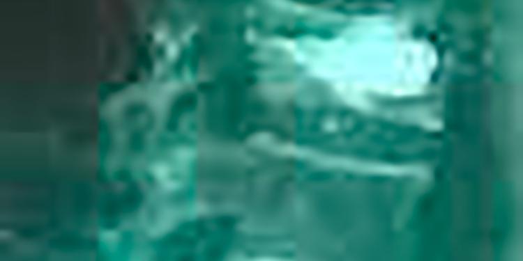 Imagen Vertebroplastias